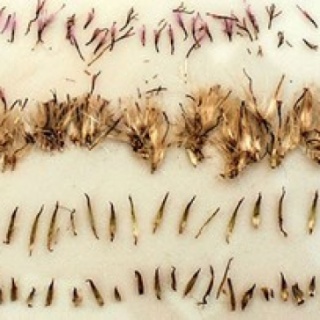 Kai Lossgott wins the 2015 Barclays L'Atelier Award